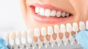 hvitt smil - Ishop hvitt smilnbsp16 juni 2021nbsp