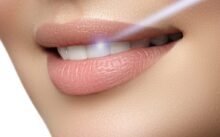 Hva er egentlig tannbleking?